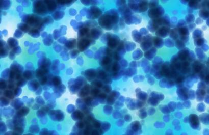 Cancer cells under microscope. Image credit: BORIS via Adobe Stock.