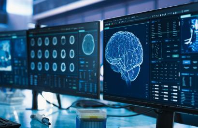 Image by Gorodenkoff via Shutterstock. Close Up of a Set of Desktop Computer Monitors Showing CT Scans Of Human Brain.